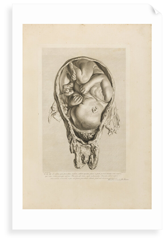 Foetus in the womb by Jean-Baptiste Michel