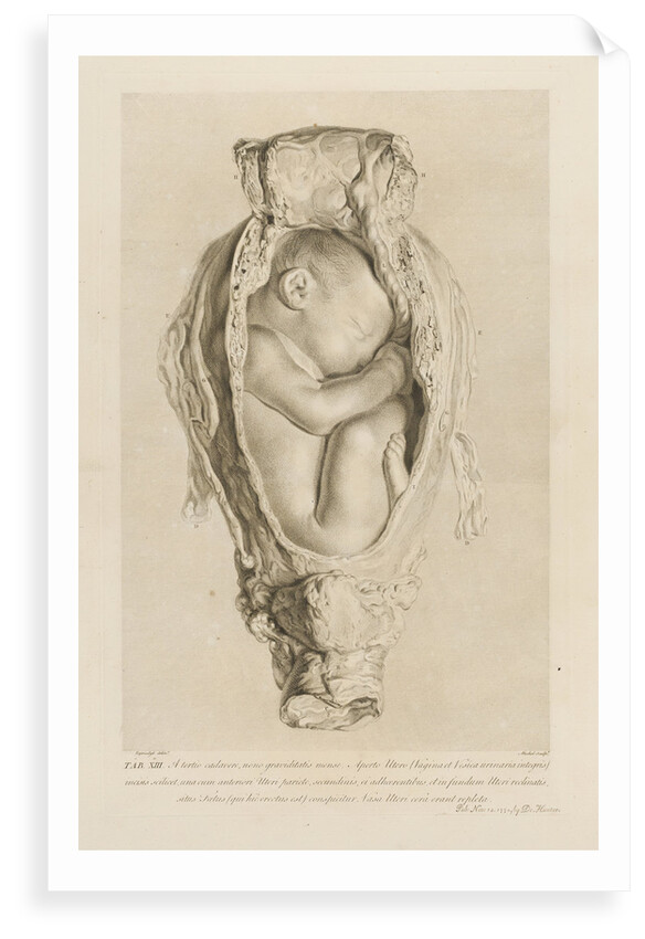 Foetus in the womb by Christian von Mechel