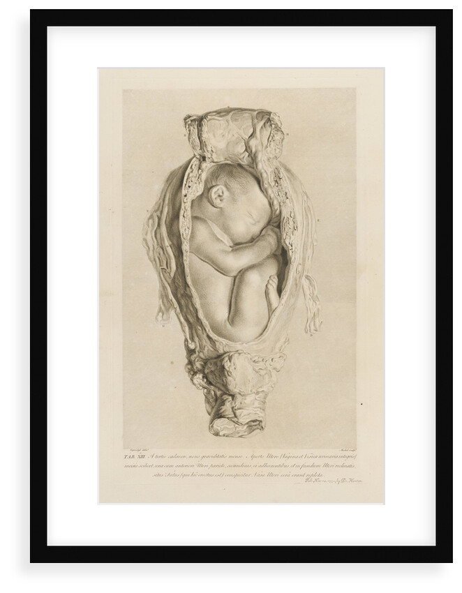Foetus in the womb by Christian von Mechel