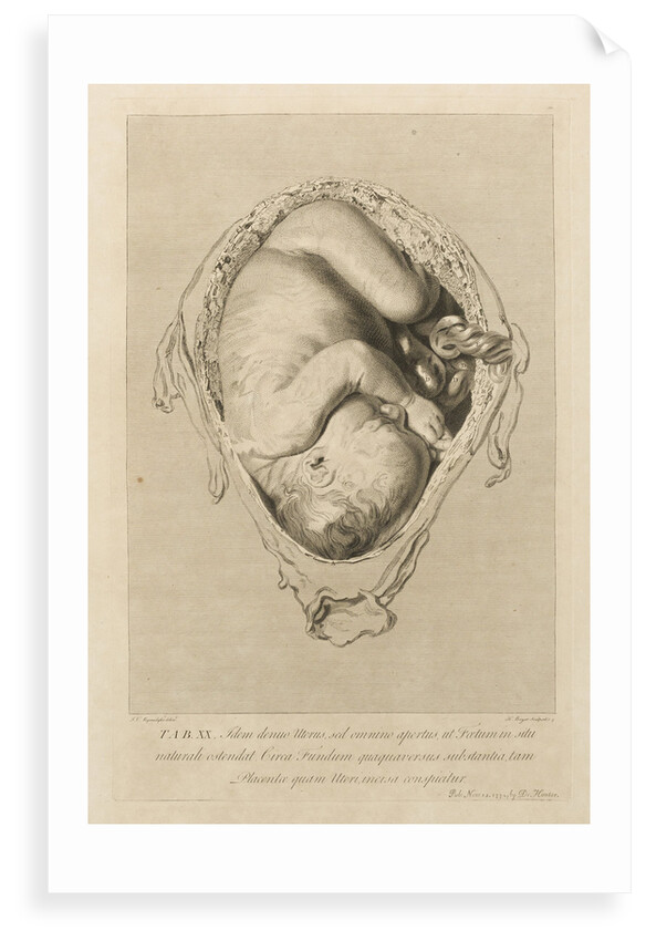 Foetus in the womb by Henry Bryer