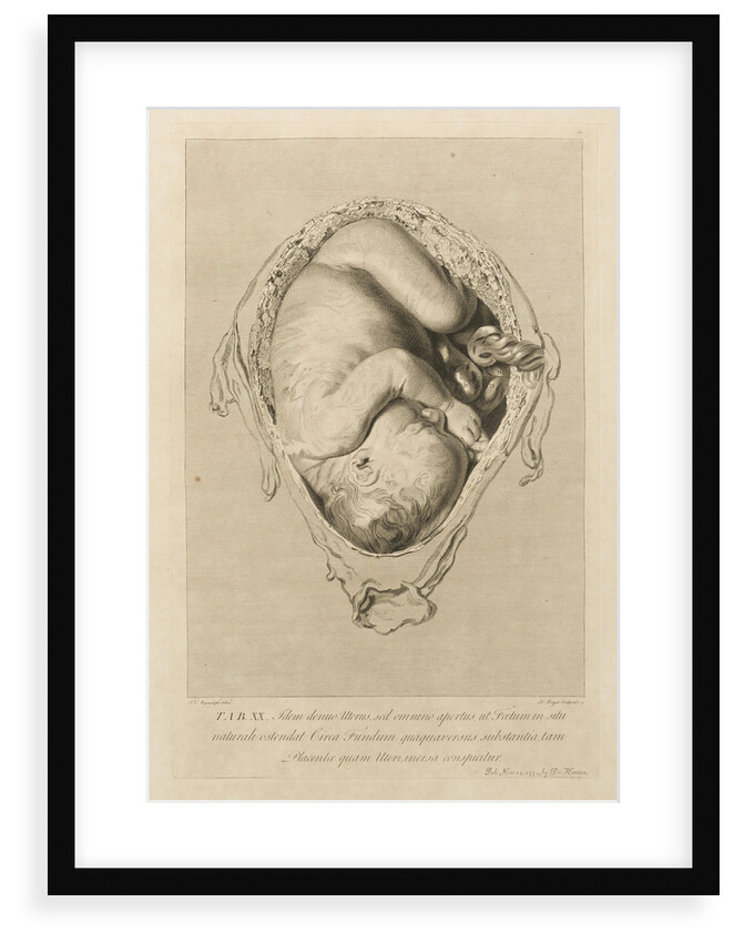 Foetus in the womb by Henry Bryer