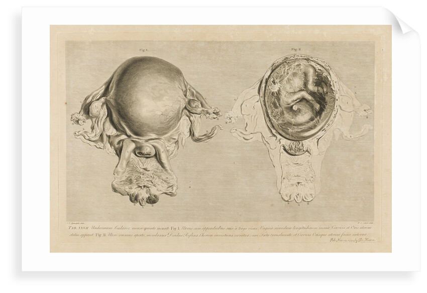 Human gravid uterus by Pierre-Charles Canot