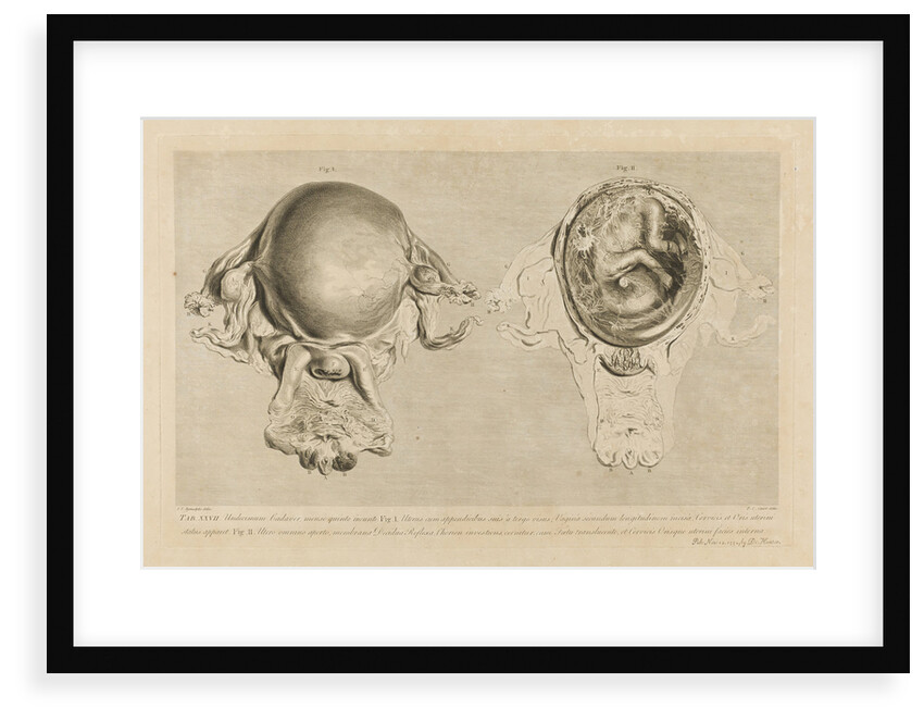Human gravid uterus by Pierre-Charles Canot
