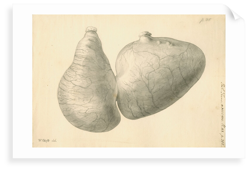 Human stomach by William Clift