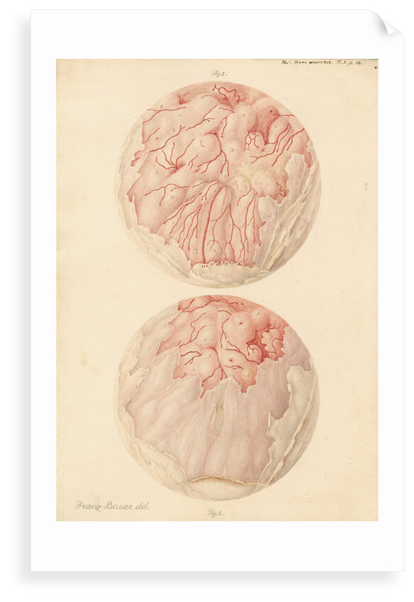 Superficial sore on a human leg by Franz Andreas Bauer