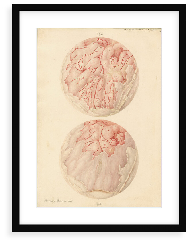 Superficial sore on a human leg by Franz Andreas Bauer