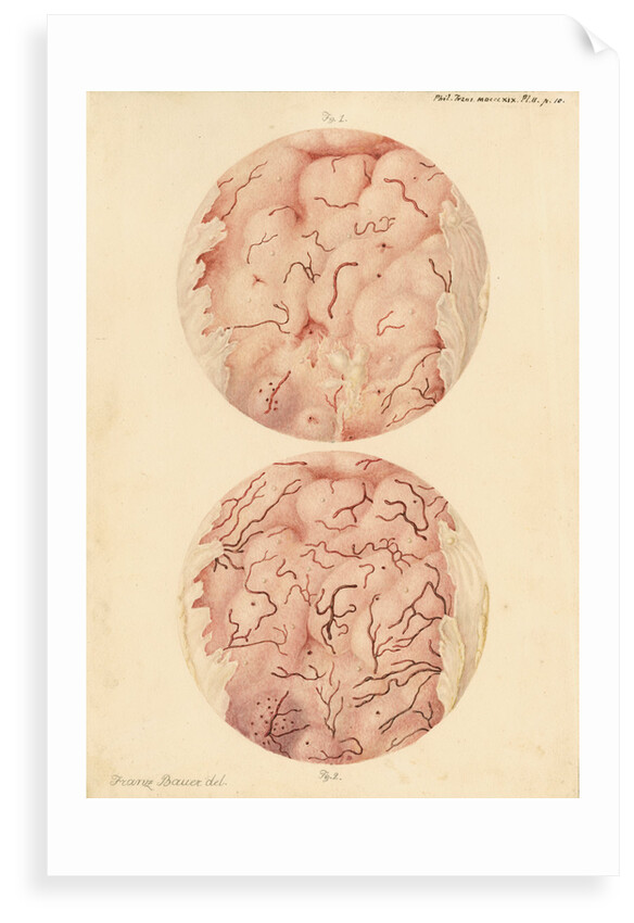 Superficial sore on a human leg by Franz Andreas Bauer