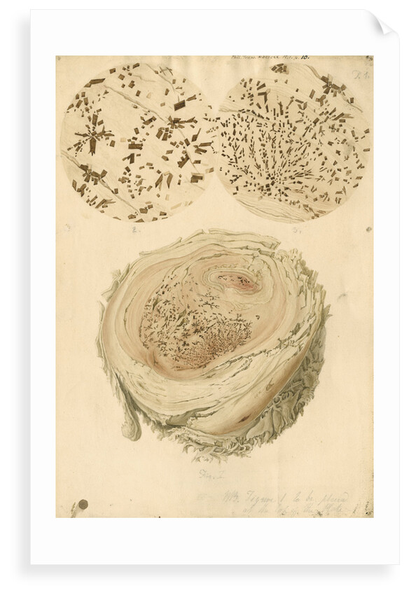 Coagulated human blood and crystals by Franz Andreas Bauer