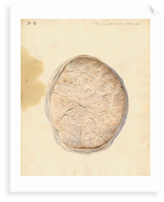 Human placenta by William Clift