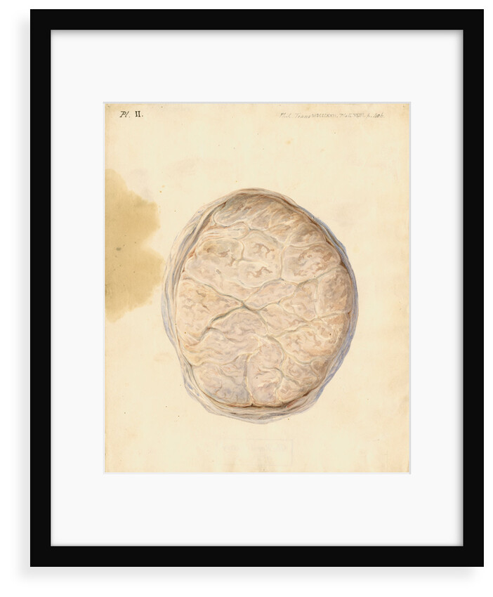 Human placenta by William Clift