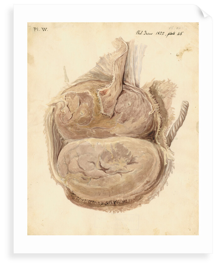 Monkey placenta by William Clift