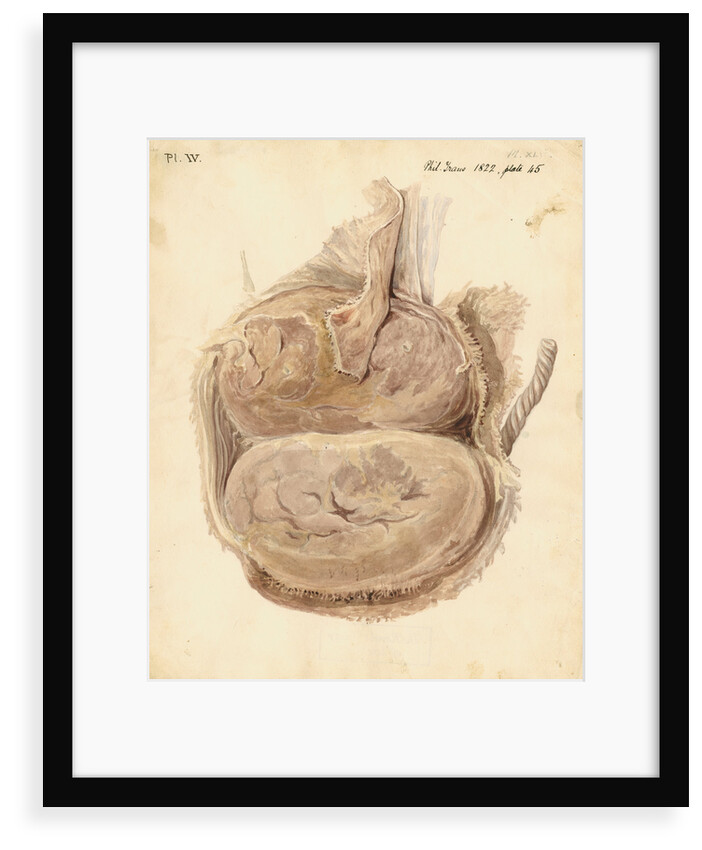 Monkey placenta by William Clift