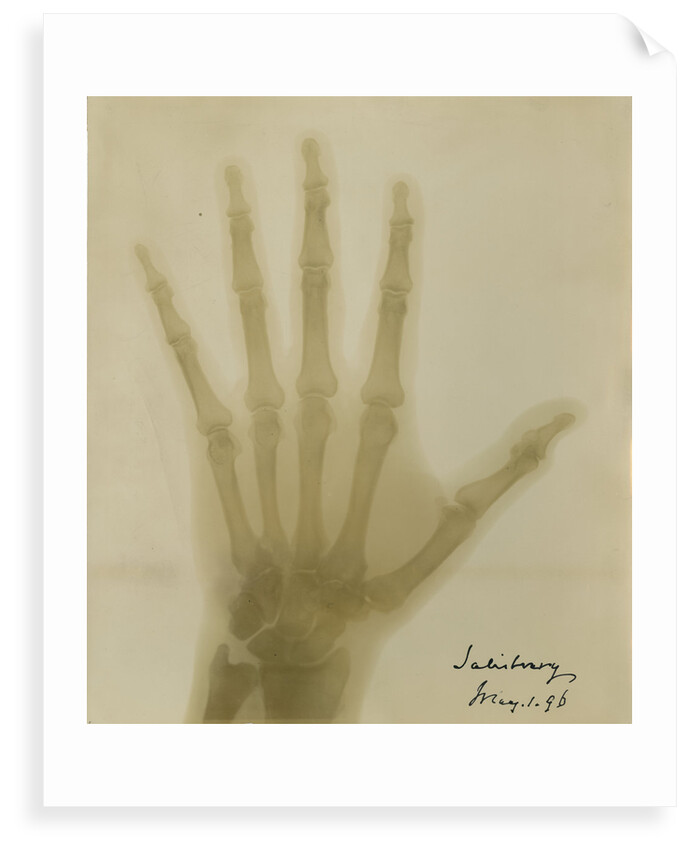 X-ray photograph of the hand of Robert Arthur Talbot Gascoyne-Cecil by Alan Archibald Campbell Swinton