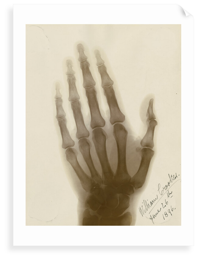 X-ray photograph of the hand of William Crookes by Alan Archibald Campbell Swinton