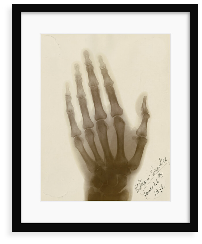X-ray photograph of the hand of William Crookes by Alan Archibald Campbell Swinton