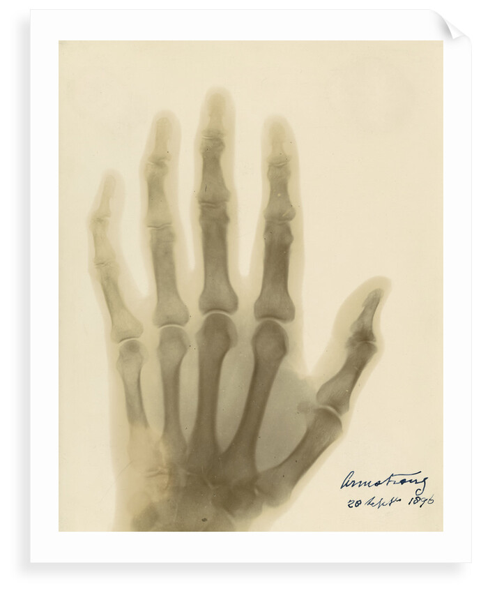 X-ray photograph of the hand of William George Armstrong by Alan Archibald Campbell Swinton