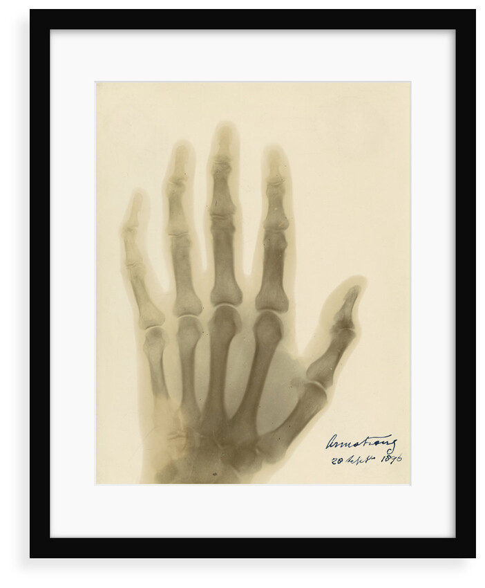 X-ray photograph of the hand of William George Armstrong by Alan Archibald Campbell Swinton