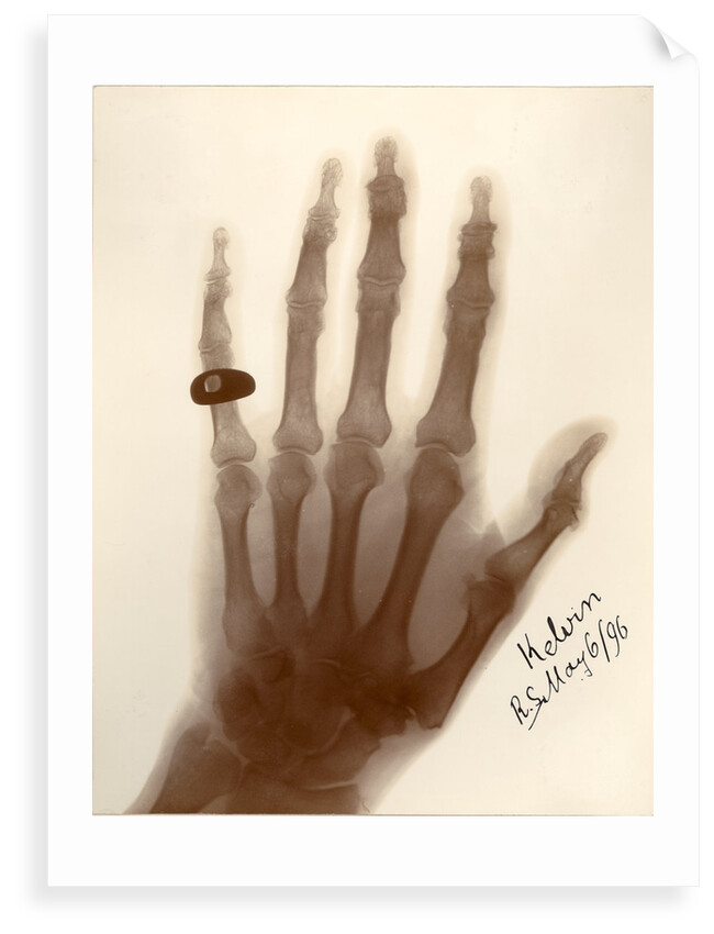 X-ray photograph of the hand of William Thomson by Alan Archibald Campbell Swinton