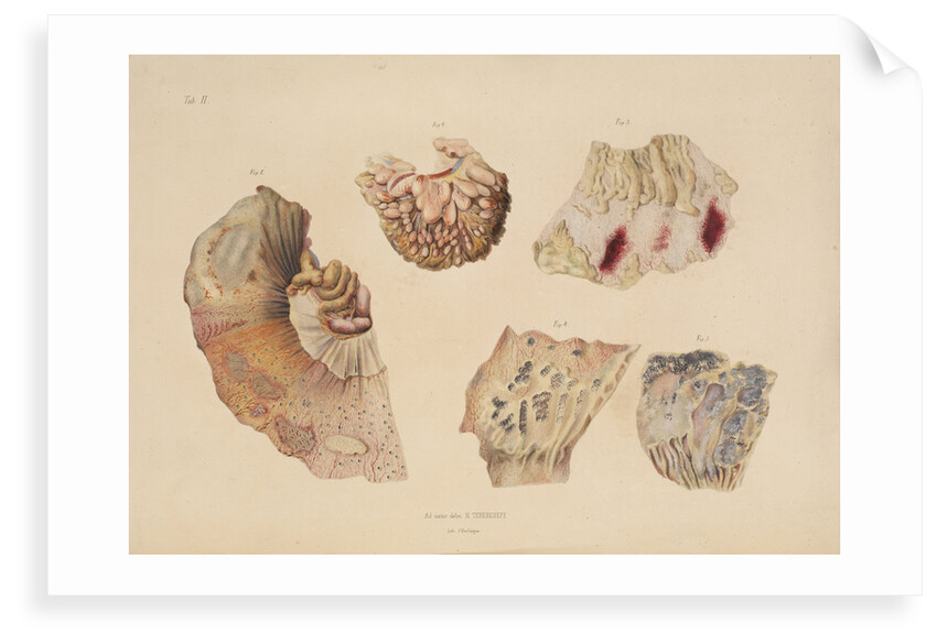 Effect of cholera on the small intestine by d'Harlingue