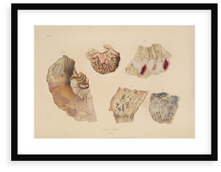 Effect of cholera on the small intestine by d'Harlingue