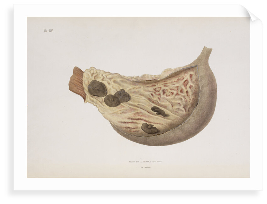The stomach of a victim of cholera by d'Harlingue
