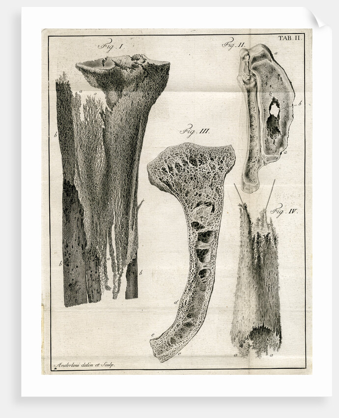 Sections of the Tibia by Faustino Anderloni