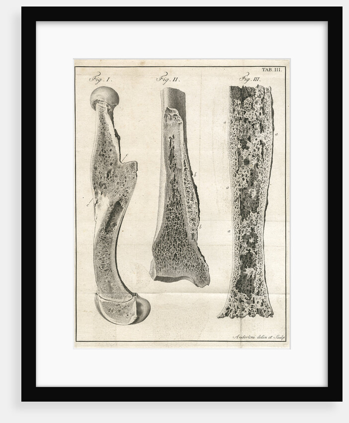 Sections of the leg bones by Faustino Anderloni