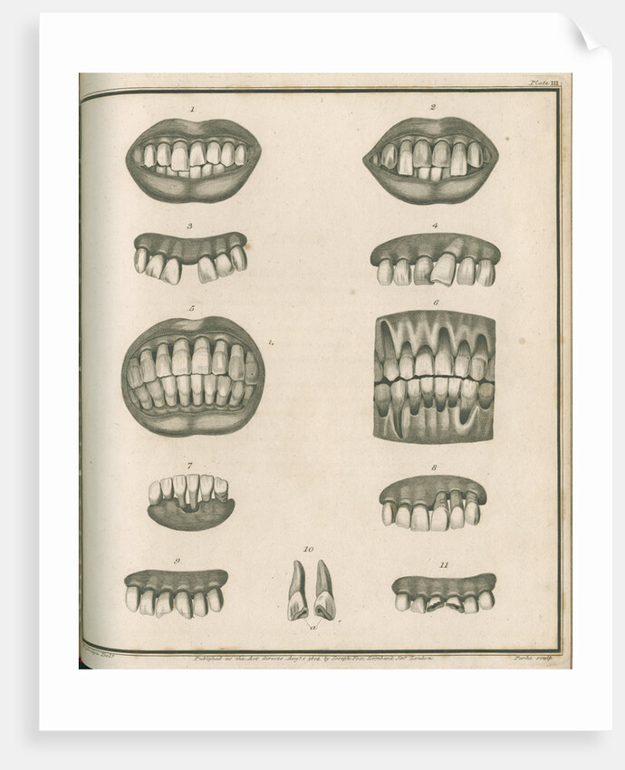 Irregularities of the teeth by Parks