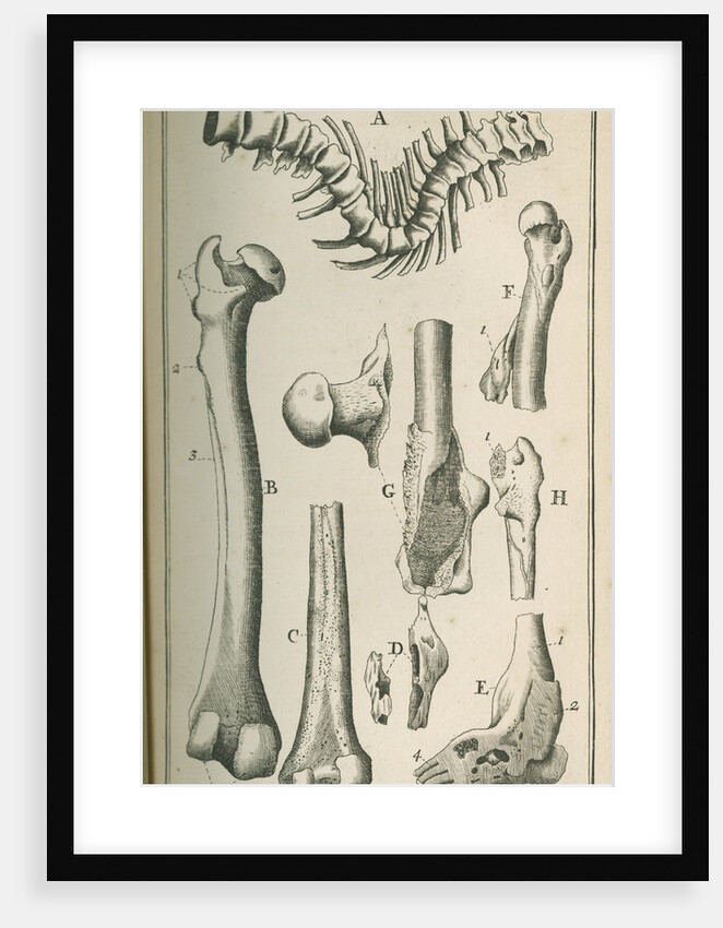 Various human bones by Sutton Nicholls