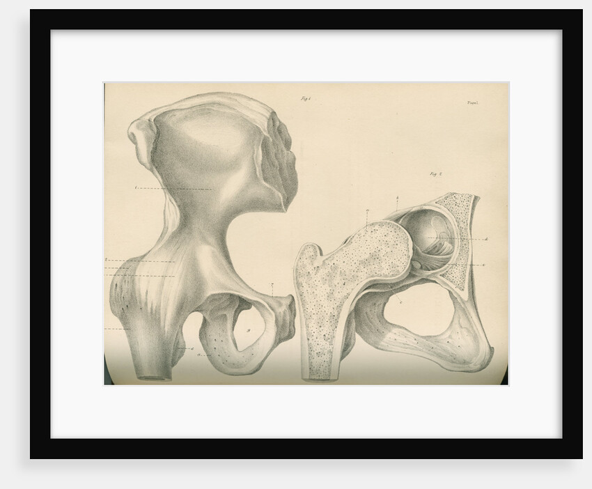 Hip bone and a portion of the femur by J Perry
