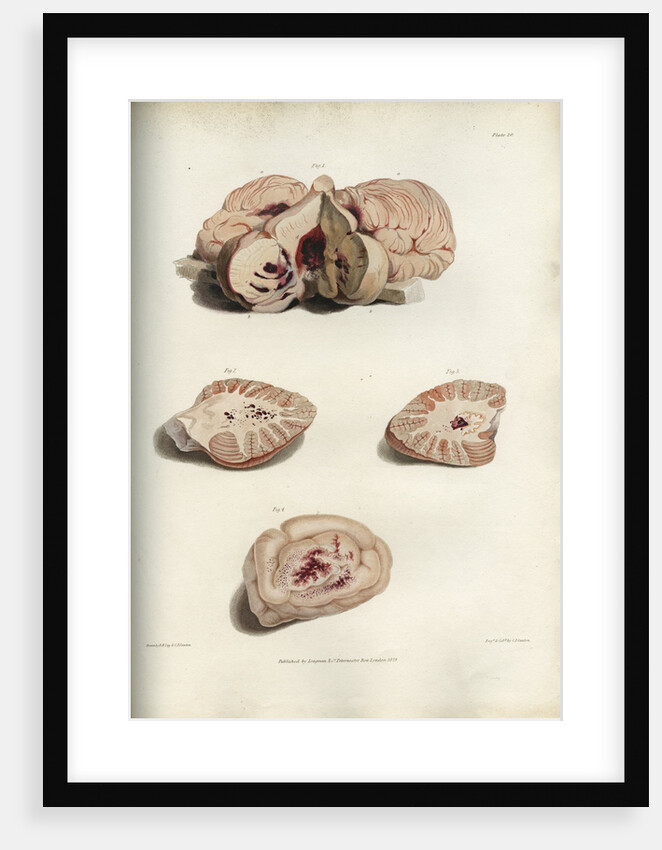 Apoplexy and concussion by C J Canton