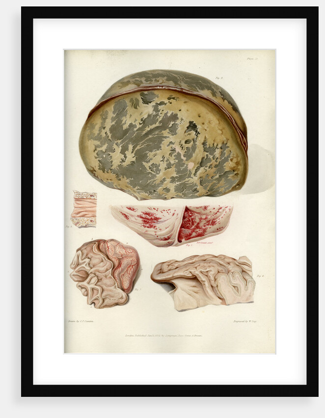 Parts of the brain including the dura mater by William Say