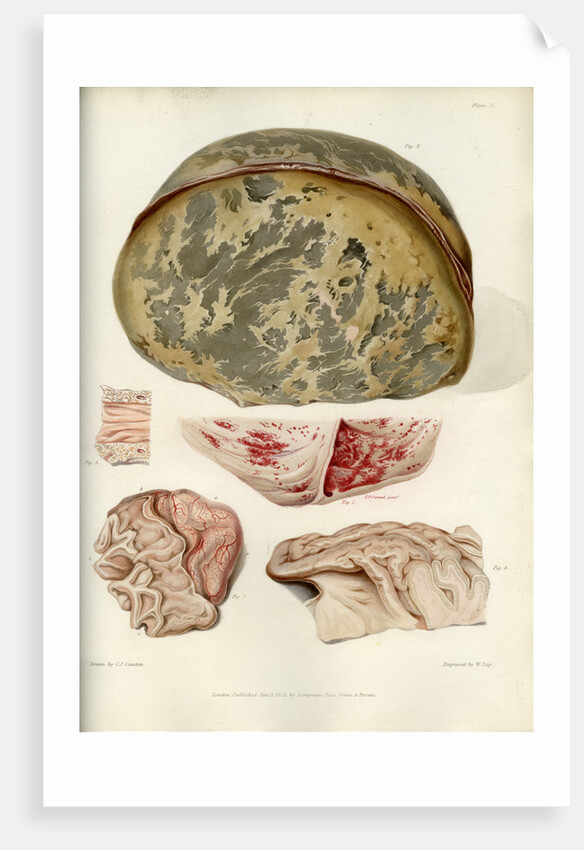 Parts of the brain including the dura mater by William Say