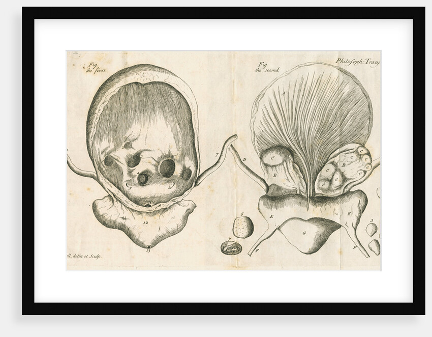 Human bladder and bladder stones by Elizabeth Blackwell