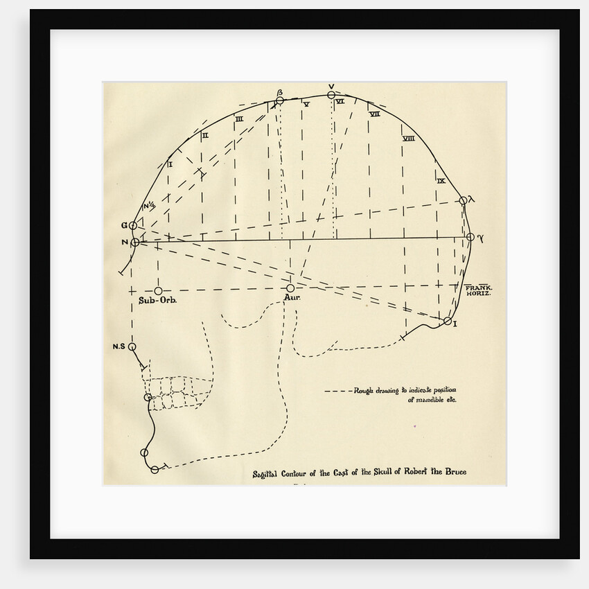 Measurements of Robert the Bruce’s skull by Unknown