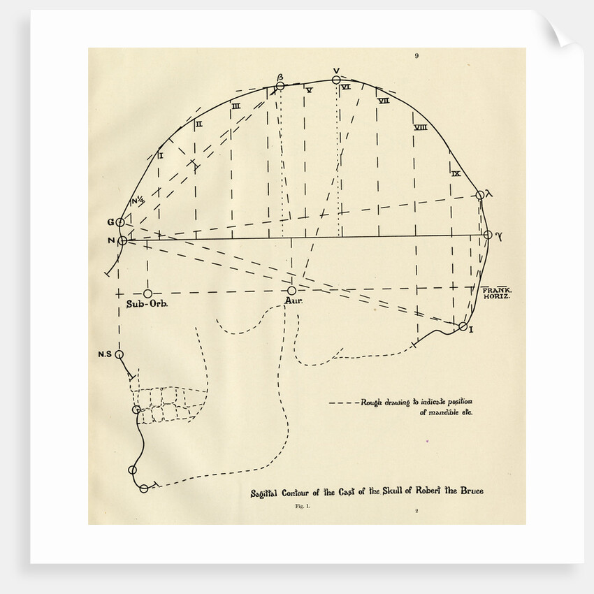 Measurements of Robert the Bruce’s skull by Unknown