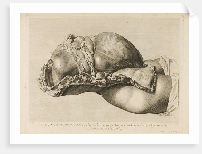 Human gravid uterus by II Scotin