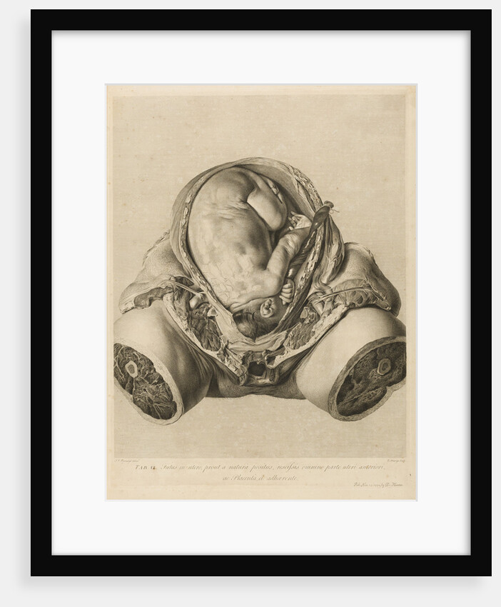 Foetus in the womb by Robert Strange