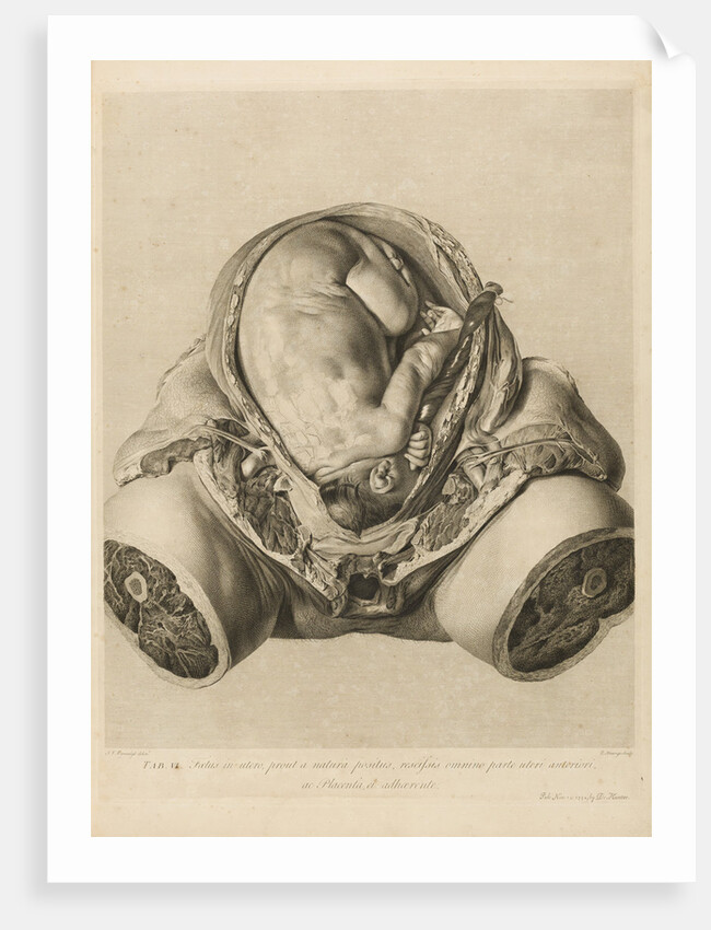 Foetus in the womb by Robert Strange