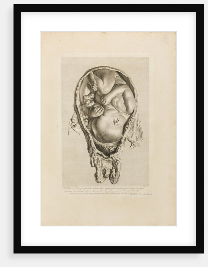 Foetus in the womb by Jean-Baptiste Michel