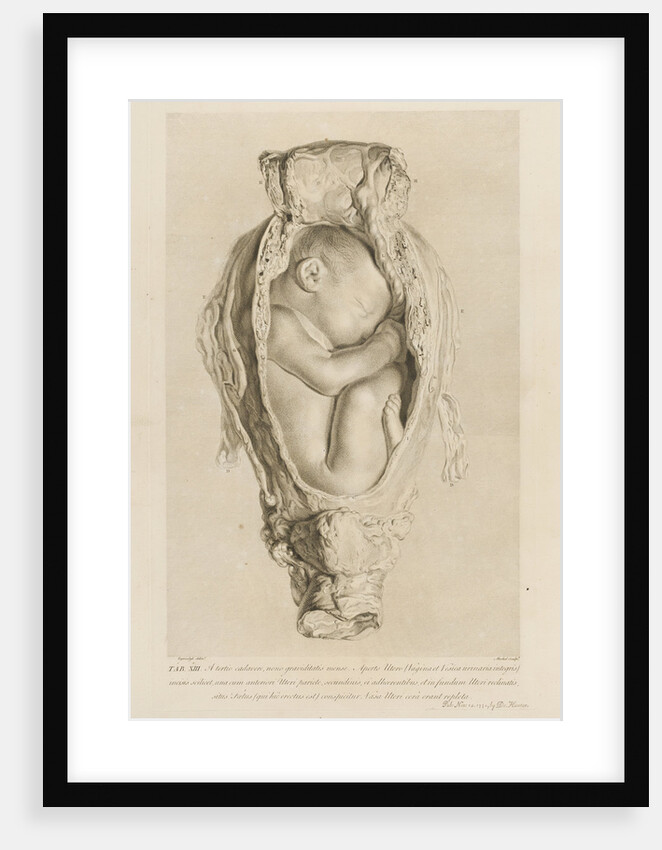 Foetus in the womb by Christian von Mechel