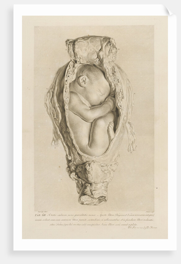 Foetus in the womb by Christian von Mechel