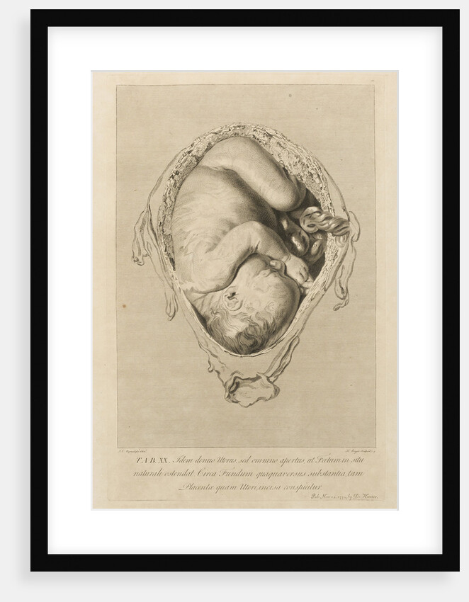 Foetus in the womb by Henry Bryer