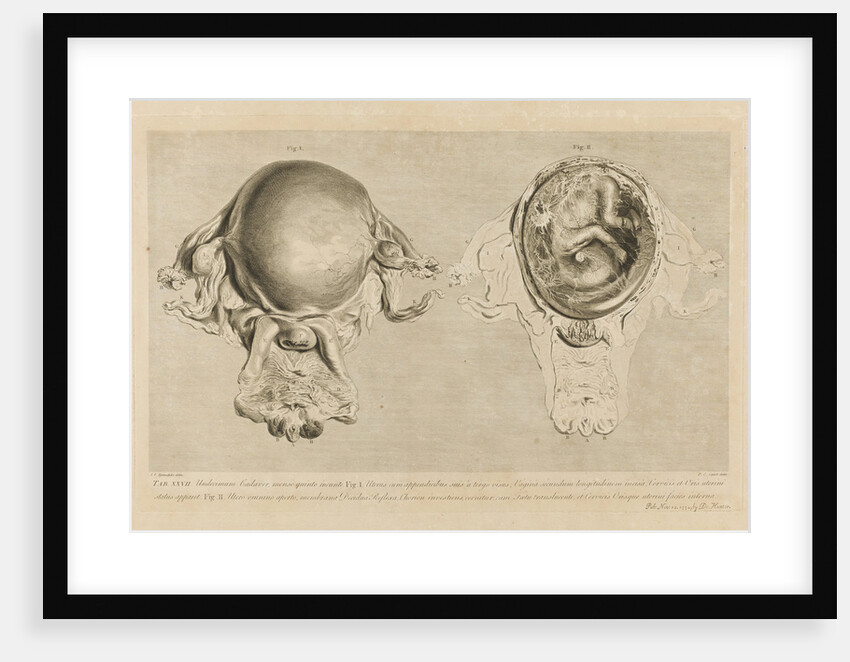Human gravid uterus by Pierre-Charles Canot