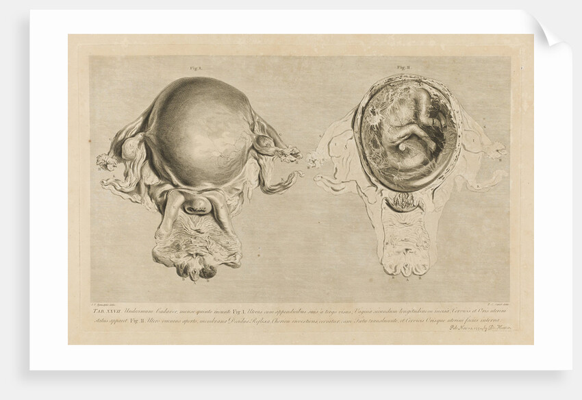 Human gravid uterus by Pierre-Charles Canot