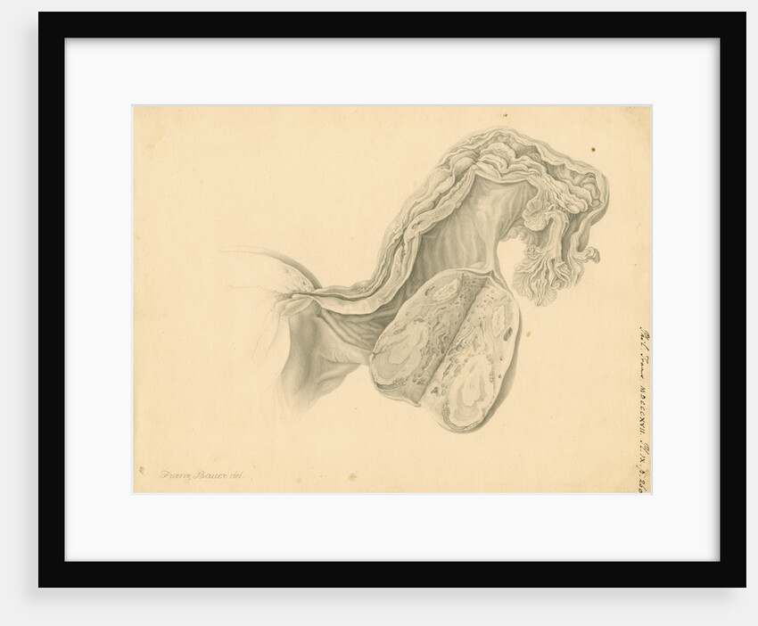 Human ovary by Franz Andreas Bauer