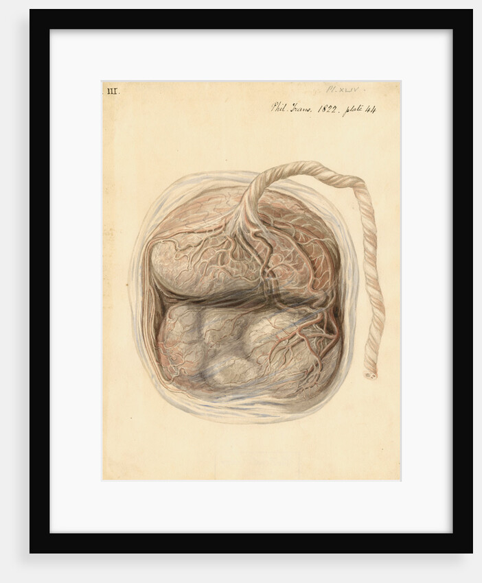 Monkey placenta by William Clift