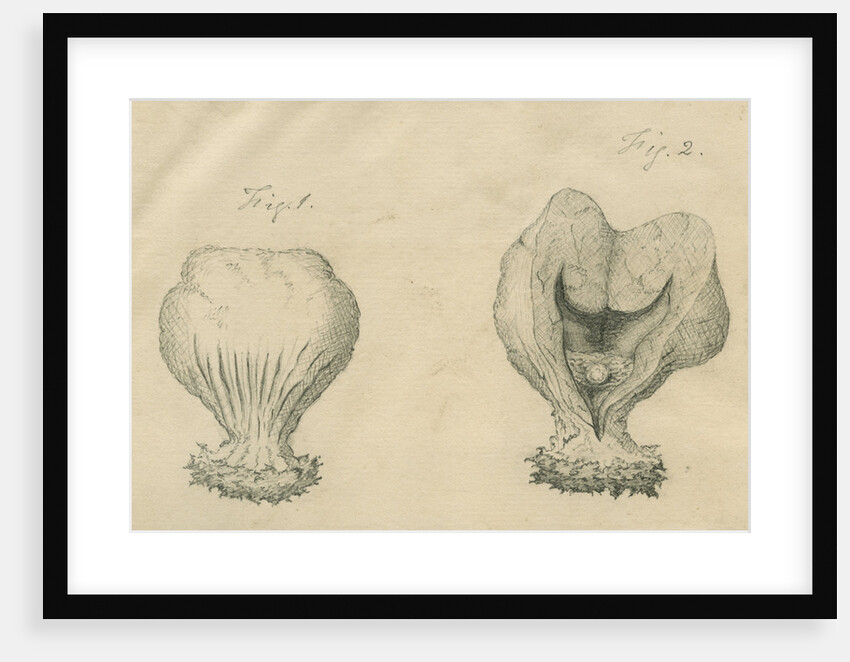 Surgically removed tumour by Caleb Burrell Rose