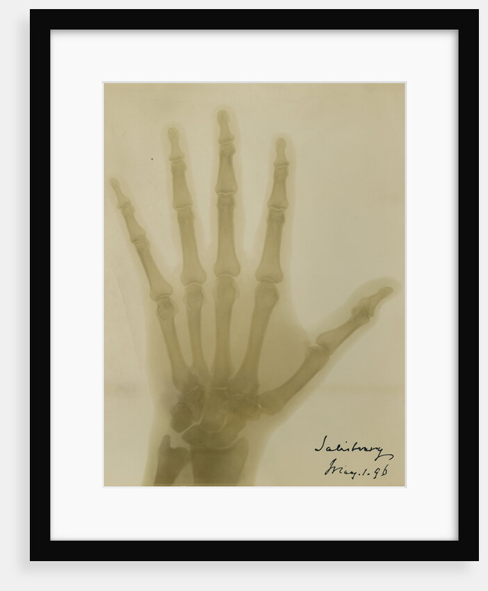 X-ray photograph of the hand of Robert Arthur Talbot Gascoyne-Cecil by Alan Archibald Campbell Swinton