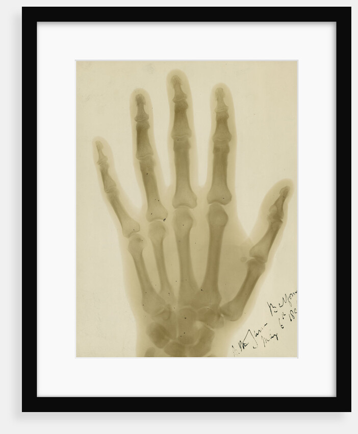 X-ray photograph of the hand of Arthur James Balfour by Alan Archibald Campbell Swinton